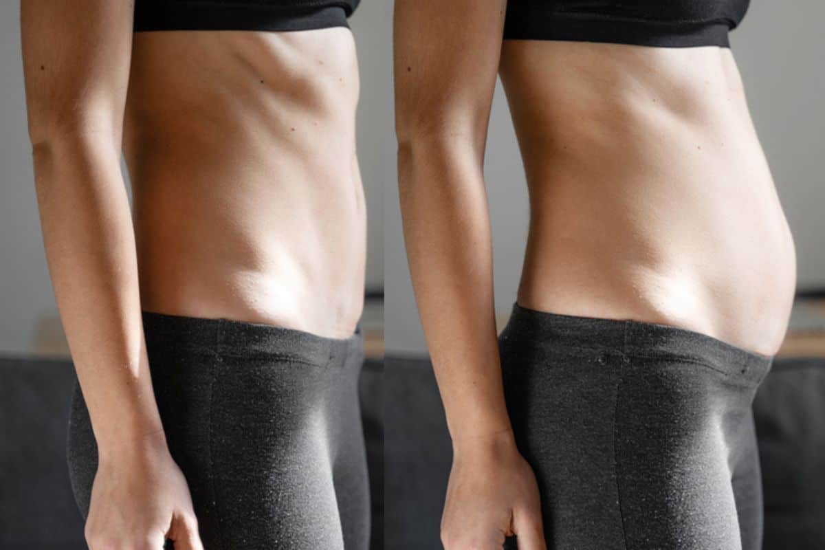 How long does diastasis recti take to improve Small Heath?
