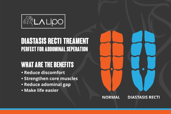 When Should You Consider Professional Help for Core Recovery Small Heath
