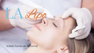 Woman receiving Actinic Keratosis Removal Treatment Small Heath