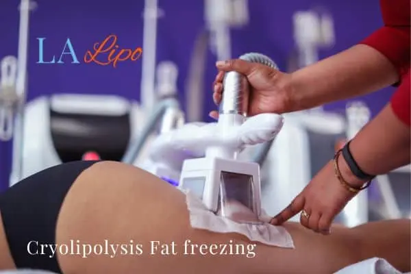 women getting fat freezing Small Heath