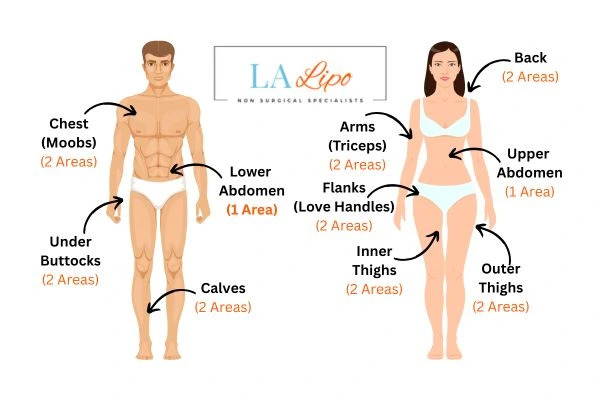 LA LIPO Cryolipolysis Areas Small Heath