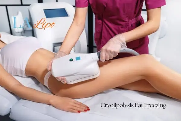 Woman receiving coolsculpting Small Heath treatment on her thighs
