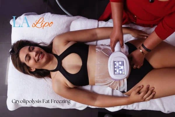 woman getting cryolipolysis Small Heath